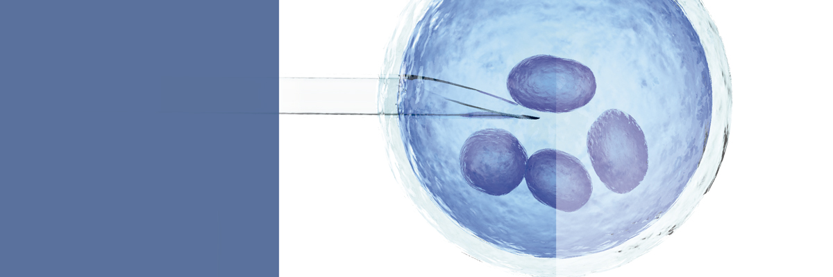 FIV - Fecundación In Vitro Conyugal